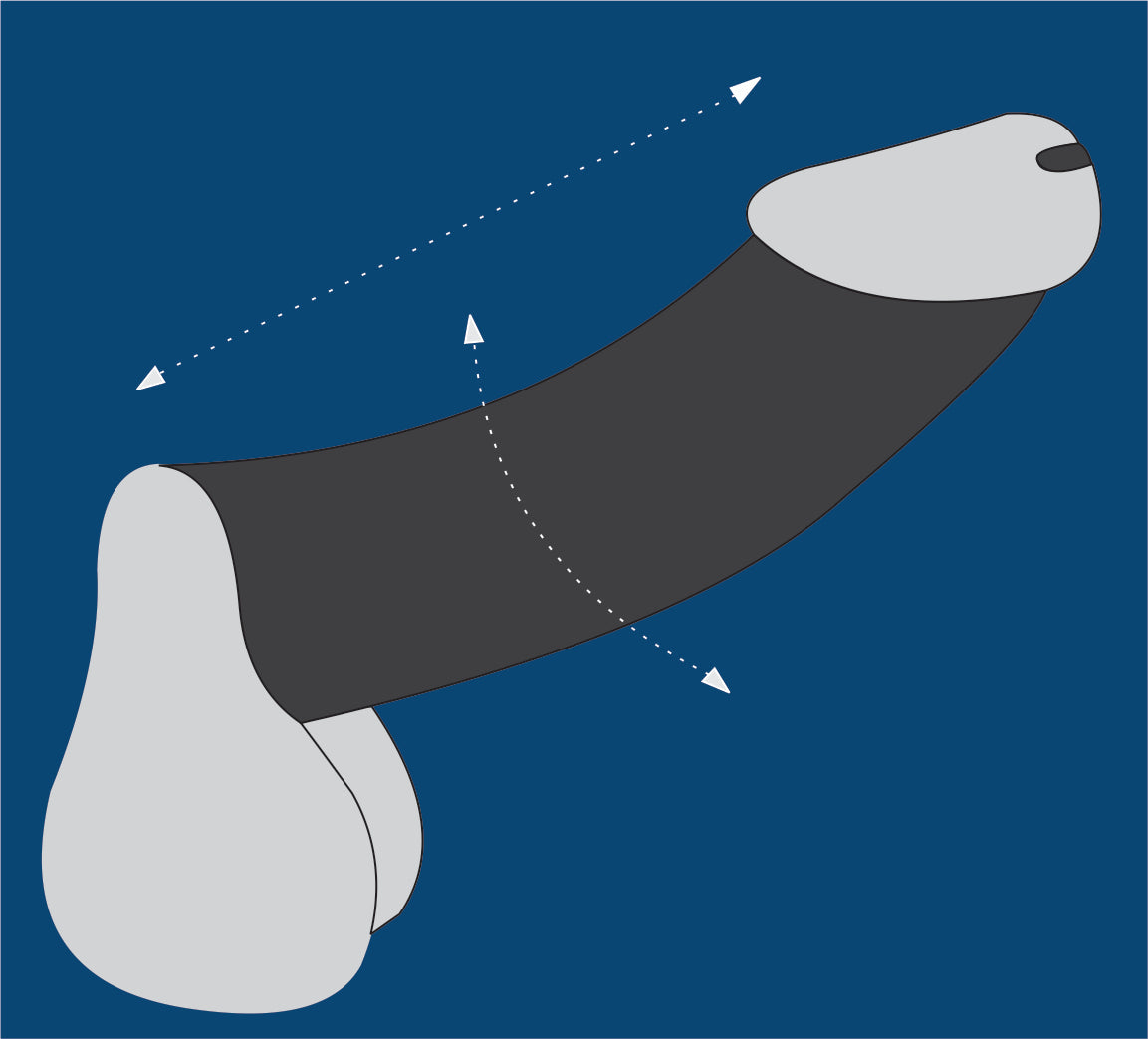 PENIS ENLARGEMENT